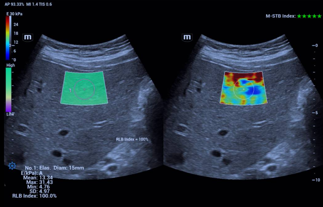 Illustrative liver examination image